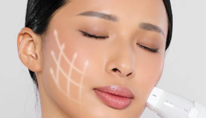 Miracle Aesthetic Clinic Ajak Generasi Muda Say YES pada Perawatan Prejuvenation